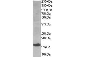 Image no. 1 for anti-Ubiquitin-Conjugating Enzyme E2I (UBE2I) (N-Term) antibody (ABIN184894)