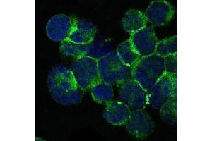 Image no. 2 for anti-IL2-Inducible T-Cell Kinase (ITK) antibody (ABIN969222)