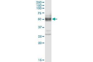 anti-Phospholipase A2, Group XV (PLA2G15) (AA 1-412) antibody