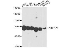 Image no. 5 for anti-Aldehyde Dehydrogenase 1 Family, Member A1 (ALDH1A1) antibody (ABIN3022573)