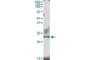 NUDT4 antibody  (AA 1-180)