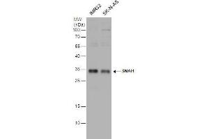 WB Image SNAI1 antibody detects SNAI1 protein by western blot analysis.