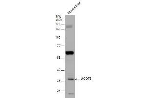 Image no. 3 for anti-Acyl-CoA Thioesterase 8 (ACOT8) (Center) antibody (ABIN2854452)