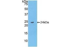 LAT2 antibody  (AA 30-209)