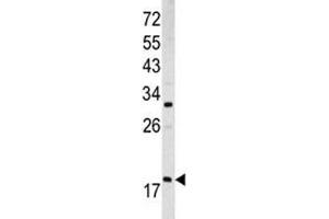Image no. 1 for anti-ADP-Ribosylation Factor 3 (ARF3) (AA 78-106) antibody (ABIN3029878)