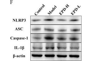 Image no. 8 for anti-Interleukin 1, beta (IL1B) (AA 101-200) antibody (ABIN728503)