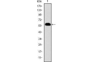 Image no. 6 for anti-Prohibitin (PHB) antibody (ABIN969353)