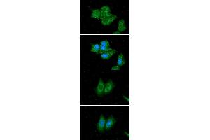 Image no. 1 for anti-Acyl-CoA Dehydrogenase, C-2 To C-3 Short Chain (Acads) antibody (ABIN5776017)