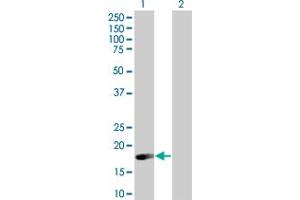 Image no. 1 for anti-Selenoprotein S (SELS) (AA 1-187) antibody (ABIN527711)