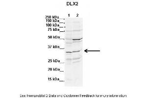Image no. 3 for anti-Distal-Less Homeobox Protein 2 (DLX2) (N-Term) antibody (ABIN2777373)