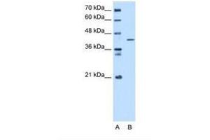 Image no. 1 for anti-Selenophosphate Synthetase 1 (SEPHS1) (C-Term) antibody (ABIN321507)