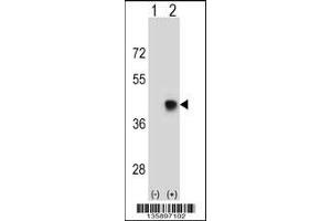 Image no. 2 for anti-Spermatid Maturation 1 (SPEM1) (AA 115-143) antibody (ABIN5538836)
