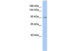 TRPV4 antibody used at 1 ug/ml to detect target protein.