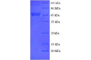 Serpin A3-2 (SERPINA3-2) (AA 25-411), (full length) protein (His tag)