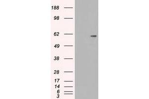 Image no. 1 for anti-Nuclear Receptor Binding Protein 1 (NRBP1) antibody (ABIN2727620)