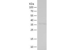 HIST1H1C Protein (AA 28-130) (His-IF2DI Tag)