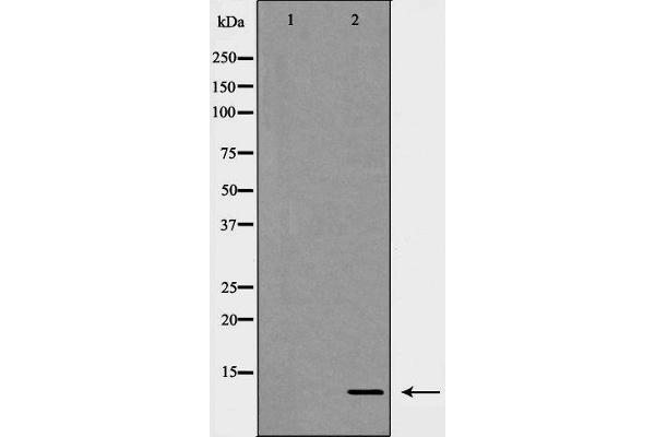 anti-Chemokine (C-X-C Motif) Ligand 1 (Melanoma Growth Stimulating Activity, Alpha) (CXCL1) (Internal Region) antibody