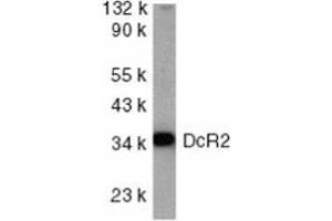Image no. 2 for anti-Tumor Necrosis Factor Receptor Superfamily, Member 10d, Decoy with Truncated Death Domain (TNFRSF10D) (AA 249-263), (Intracellular) antibody (ABIN499724)