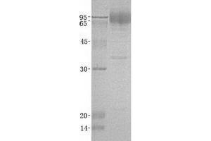 Image no. 1 for Lysosomal-Associated Membrane Protein 2 (LAMP2) (Transcript Variant C) protein (ABIN2713368)