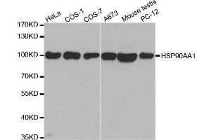 Image no. 1 for anti-Heat Shock Protein 90kDa alpha (Cytosolic), Class A Member 1 (HSP90AA1) (N-Term) antibody (ABIN3020962)