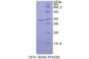 Image no. 1 for V-Rel Reticuloendotheliosis Viral Oncogene Homolog B (RELB) (AA 248-492) protein (His tag) (ABIN1877490)