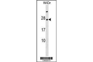 Image no. 1 for anti-TGFB-Induced Factor Homeobox 2-Like, Y-Linked (TGIF2LY) (AA 1-28), (N-Term) antibody (ABIN1538862)