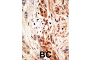 APOBEC3A antibody