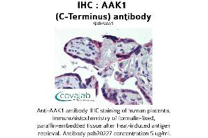 Image no. 1 for anti-AP2 associated kinase 1 (AAK1) (C-Term) antibody (ABIN1731398)