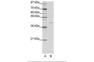 Image no. 2 for anti-Eukaryotic Translation Initiation Factor 3, Subunit G (EIF3G) (AA 42-91) antibody (ABIN202234)