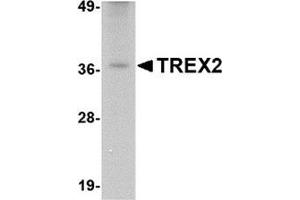 Image no. 2 for anti-three Prime Repair Exonuclease 2 (Trex2) (C-Term) antibody (ABIN501038)