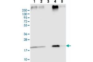 Image no. 2 for anti-Transmembrane Protein 205 (TMEM205) antibody (ABIN5589678)