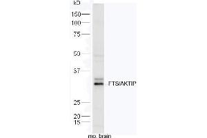 Image no. 1 for anti-AKT Interacting Protein (AKTIP) (AA 201-292) antibody (ABIN2559493)