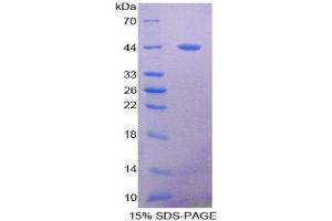 Image no. 1 for Mucin 5 Subtype B (MUC5B) (AA 898-1002) protein (His tag,GST tag) (ABIN1980809)
