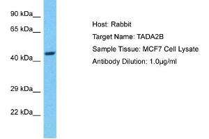 anti-Transcriptional Adaptor 2B (TADA2B) (C-Term) antibody