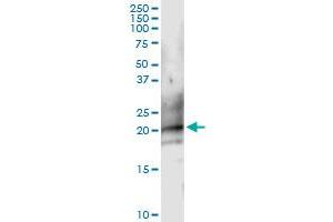 Image no. 1 for anti-CD160 (CD160) (AA 1-181) antibody (ABIN524537)