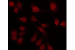 Image no. 1 for anti-G Protein-Coupled Receptor 75 (GPR75) (Internal Region) antibody (ABIN6258191)