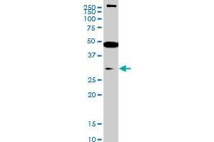 Image no. 5 for anti-SET Domain Containing (Lysine Methyltransferase) 7 (SETD7) (AA 257-366) antibody (ABIN566461)