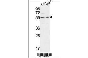 Image no. 1 for anti-DEAD (Asp-Glu-Ala-Asp) Box Polypeptide 6 (DDX6) (AA 348-375) antibody (ABIN653855)