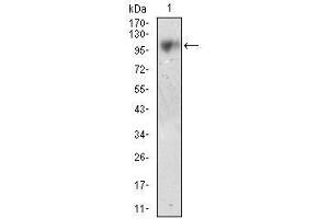 Western blot analysis using CD10 mouse mAb against LNCAP cell lysate.
