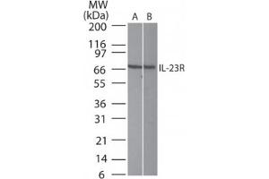 Image no. 2 for anti-Interleukin 23 Receptor (IL23R) (AA 400-470) antibody (ABIN6734998)