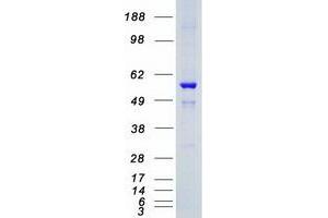 Image no. 1 for serum/glucocorticoid Regulated Kinase Family, Member 3 (SGK3) (Transcript Variant 1) protein (Myc-DYKDDDDK Tag) (ABIN2731934)