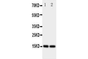 Image no. 2 for anti-Fatty Acid Binding Protein 5 (Psoriasis-Associated) (FABP5) (AA 10-23), (N-Term) antibody (ABIN3044084)