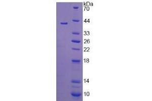Image no. 1 for Hydroxysteroid (11-Beta) Dehydrogenase 2 (HSD11B2) (AA 58-393) protein (His tag) (ABIN6237379)