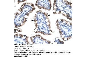 Image no. 3 for anti-Activating Transcription Factor 2 (ATF2) (C-Term) antibody (ABIN2778291)