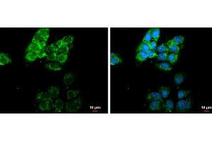 ICC/IF Image MMP13 antibody [N3C1], Internal detects MMP13 protein at cytoplasm by immunofluorescent analysis.
