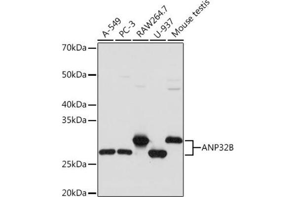 ANP32B 抗体