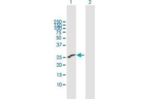 Western Blot analysis of IGSF6 expression in transfected 293T cell line by IGSF6 MaxPab polyclonal antibody.