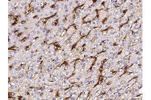 Image no. 1 for anti-Fc Fragment of IgG, Low Affinity IIIa, Receptor (CD16a) (FCGR3A) (AA 1-208) antibody (ABIN2649217)
