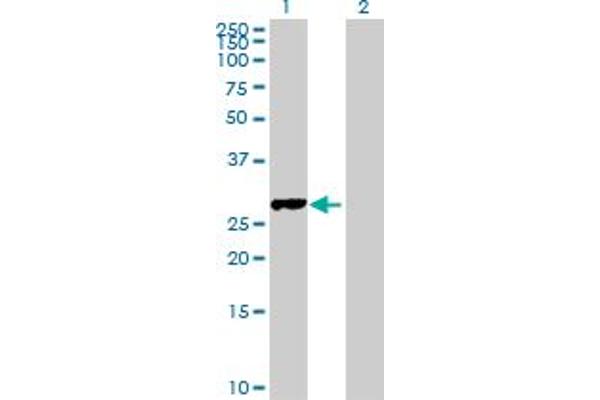 anti-Family with Sequence Similarity 9, Member B (FAM9B) (AA 1-186) antibody
