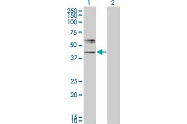 anti-UDP-GlcNAc:BetaGal beta-1,3-N-Acetylglucosaminyltransferase 2 (B3GNT2) (AA 111-210) antibody
